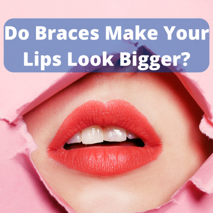 Do Braces Change Your Jawline? Best Orthodontist USA