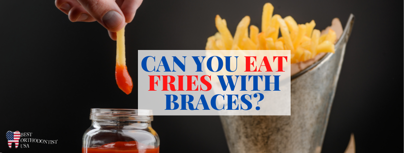 can-you-eat-fries-with-braces-2022-answer